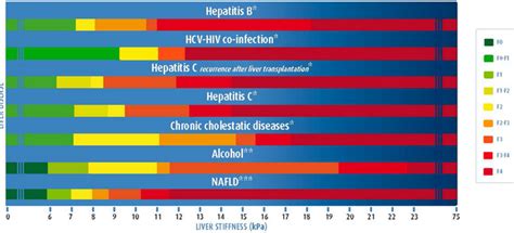 fibroscan score chart|liver fibroscan score card results.